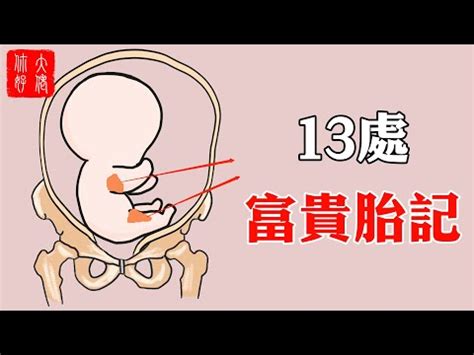 大腿胎記|【大腿胎記】大腿胎記藏著前世今生的秘密！胎記位置大解析，揭。